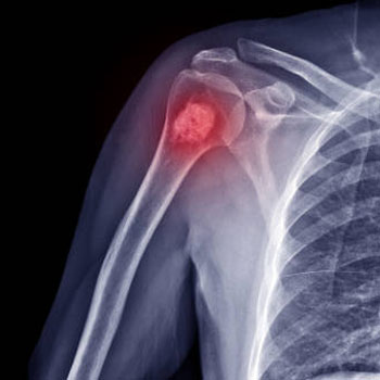 Orthopaedic Oncology Hospital Gudivada